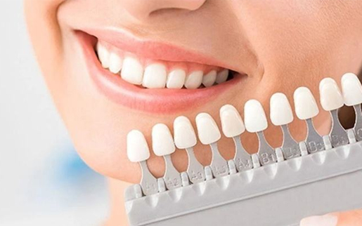 牙齿美白和洗牙是一回事吗？