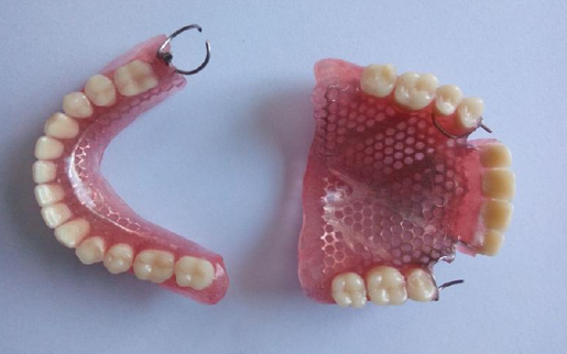 常见的假牙有哪几种？