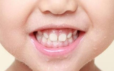 <b>Common problems in childrens dental replacement</b>