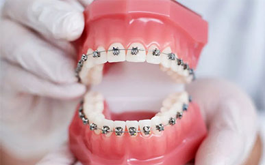 <b>有关金属牙套矫正您了解多少？</b>